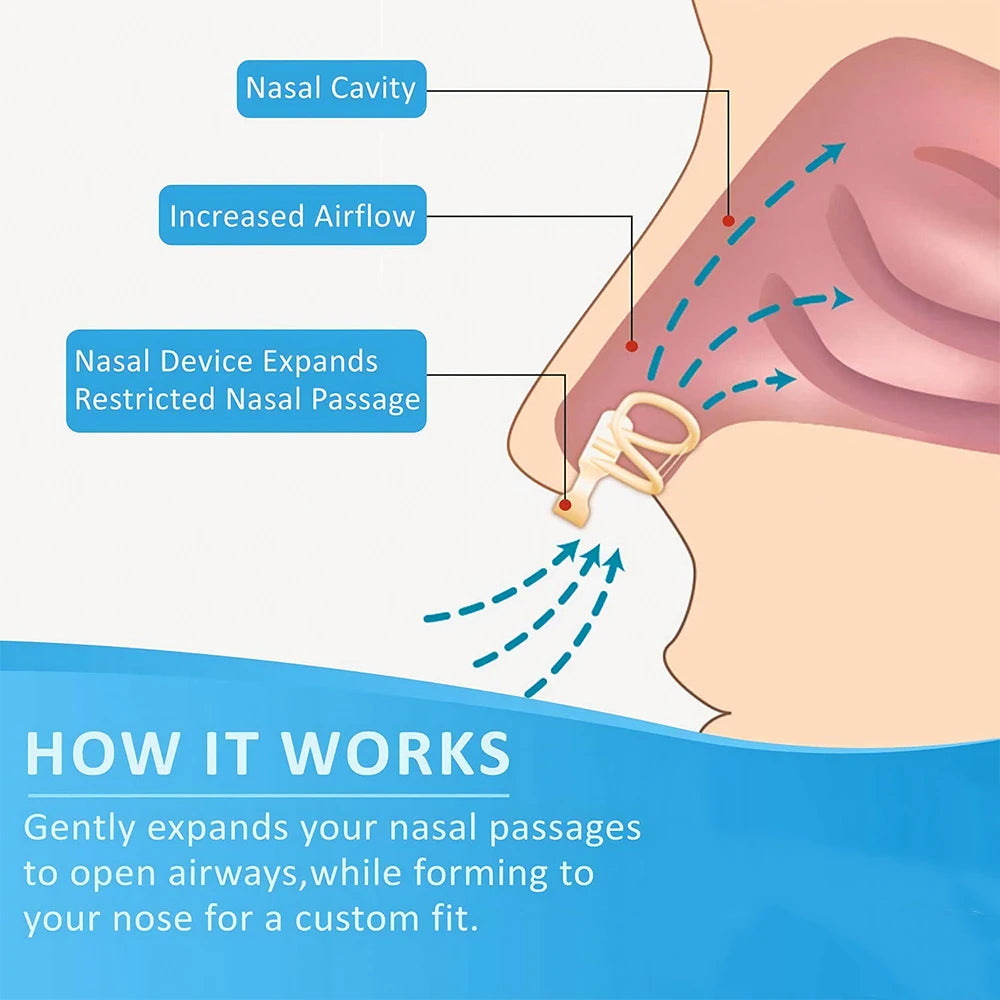 Anti-Snoring Nose Clip – Comfortable Nasal Dilator for Better Sleep & Snore Relief
