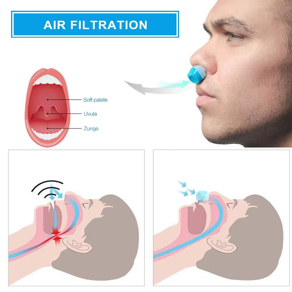 Anti-Snoring Nose Guard – Comfortable Silicone Nasal Tray for Better Breathing & Nighttime Sleep